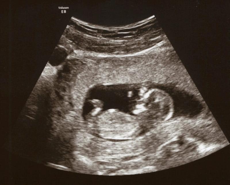 Этапы развития плода