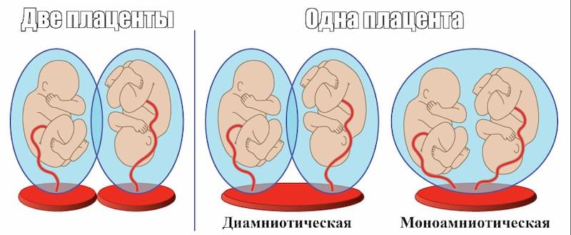 Двуплодная беременность